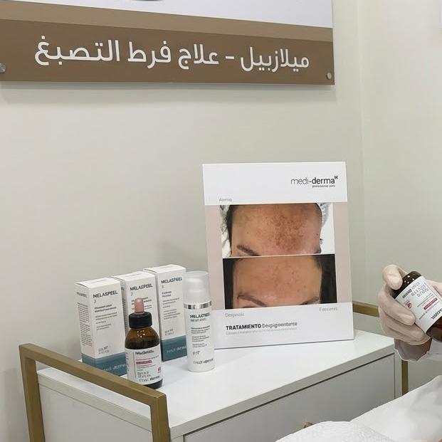 تقشير بارد ميلازبيل