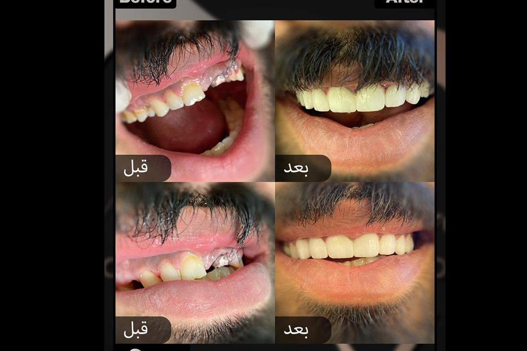 Dr. Mohannad Alaswad Cosmetic & Dentistry photo 2
