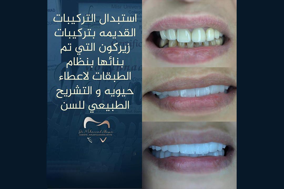 Dr. Mohannad Alaswad Cosmetic & Dentistry photo 3