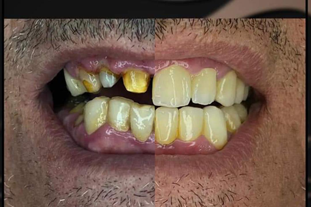 Dr. Mohannad Alaswad Cosmetic & Dentistry photo 5