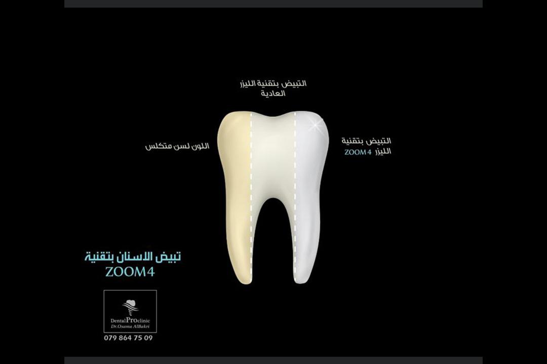 Dental Pro Clinic Dr. Osama Albakri photo 2